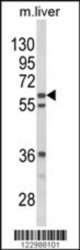 Western blot of GRB14 Antibody (N-term) in mouse liver tissue lysates (35 ug/lane). GRB14 (arrow) was detected using the purified Pab.