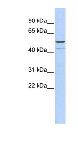 KCNK12 antibody LS-C110023 Western blot of OVCAR-3 cell lysate.