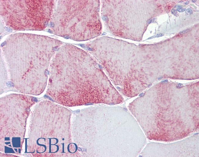Anti-KCNK13 antibody IHC of human skeletal muscle. Immunohistochemistry of formalin-fixed, paraffin-embedded tissue after heat-induced antigen retrieval. Antibody LS-B7109 concentration 5 ug/ml.