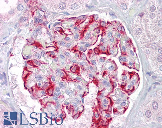 Anti-KCNK13 antibody IHC of human kidney. Immunohistochemistry of formalin-fixed, paraffin-embedded tissue after heat-induced antigen retrieval. Antibody LS-B7109 concentration 5 ug/ml.