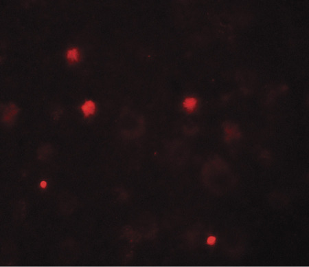 Immunofluorescence of KCNK13 in human brain tissue with KCNK13 antibody at 20 ug/ml.