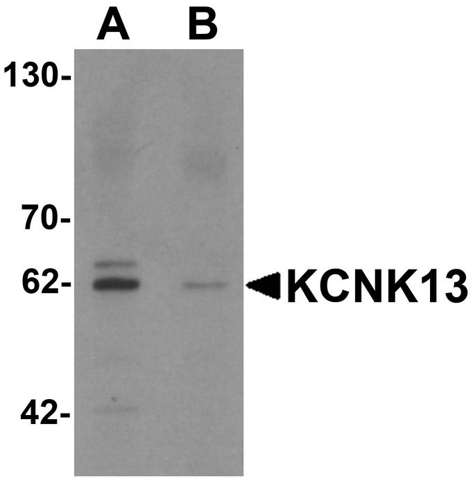 Western blot analysis of KCNK13 in rat brain tissue lysate with KCNK13 antibody at 0.5 ug/ml in (A) the absence and (B) the presence of blocking peptide.