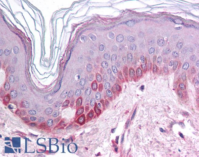 Anti-KCNK13 antibody IHC of human skin. Immunohistochemistry of formalin-fixed, paraffin-embedded tissue after heat-induced antigen retrieval. Antibody LS-B978 concentration 5 ug/ml.