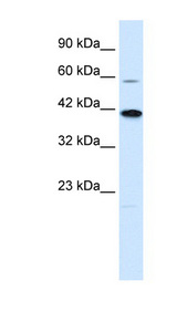 KCNK13 antibody LS-B978 Western blot of Jurkat lysate.