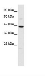 Jurkat Cell Lysate