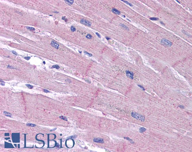 Anti-KCNK18 / TRESK antibody IHC of human heart. Immunohistochemistry of formalin-fixed, paraffin-embedded tissue after heat-induced antigen retrieval. Antibody LS-B5066 concentration 5 ug/ml.