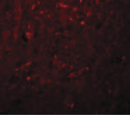 Immunofluorescence of TRESK in Rat Brain cells with TRESK antibody at 20 ug/ml.