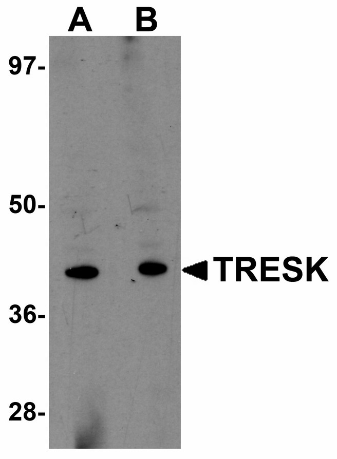 Western blot of TRESK in rat brain tissue lysate with TRESK antibody at (A) 1 and (B) 2 ug/ml.