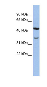 KCNK4 antibody LS-C110033 Western blot of Jurkat lysate.