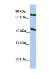HepG2 cell lysate. Antibody concentration: 1.0 ug/ml. Gel concentration: 12%.