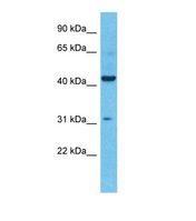 Western blot of Human Colorectal Tumor. KCNK4 antibody dilution 1.0 ug/ml.