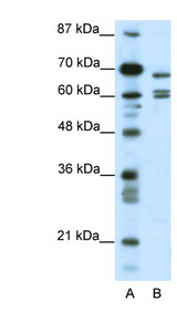 KCNK5 antibody LS-B979 Western blot of HepG2 cell lysate.