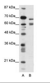 A: Marker, B: HepG2 Cell Lysate