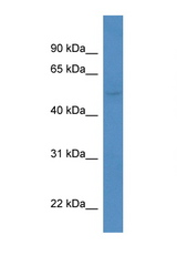 KCNK5 antibody LS-C135026 Western blot of Mouse Liver lysate. Antibody concentration 1 ug/ml.