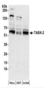 Detection of Human TASK-2 by Western Blot. Samples: Whole cell lysate (50 ug) prepared using NETN buffer from HeLa, 293T, and Jurkat cells. Antibodies: Affinity purified rabbit anti-TASK-2 antibody used for WB at 0.4 ug/ml. Detection: Chemiluminescence with an exposure time of 3 minutes.
