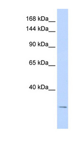 KCNK6 antibody LS-C110195 Western blot of HeLa lysate.