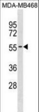 KCNK6 Antibody western blot of MDA-MB468 cell line lysates (35 ug/lane). The KCNK6 antibody detected the KCNK6 protein (arrow).