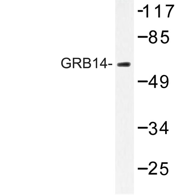Western blot of GRB14 (D123) pAb in extracts from HUVEC cells.