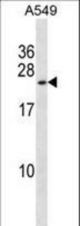 KCNMB1 Antibody western blot of A549 cell line lysates (35 ug/lane). The KCNMB1 antibody detected the KCNMB1 protein (arrow).