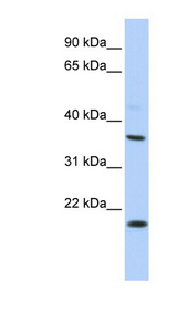 KCNMB3 antibody LS-C110038 Western blot of HepG2 cell lysate.