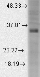 Western blot analysis of BKBeta3a in rat brain membrane lysates using a 1:1000 dilution of KCNMB3 antibody.