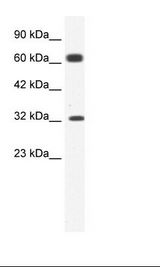 KCNN1 antibody (1.25ug/ml) western blot of Jurkat Cell Lysate.