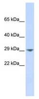Lane: Fetal Muscle Lysate
