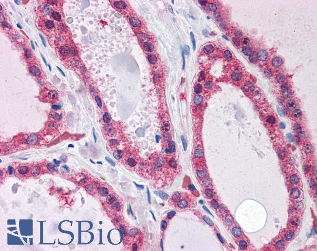 Anti-KCNN2 antibody IHC of human thyroid. Immunohistochemistry of formalin-fixed, paraffin-embedded tissue after heat-induced antigen retrieval. Antibody LS-B4408 concentration 3.75 ug/ml.