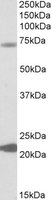 KCNN2 antibody (0.3 ug/ml) staining of Human Liver lysate (35 ug protein in RIPA buffer). Primary incubation was 1 hour. Detected by chemiluminescence.