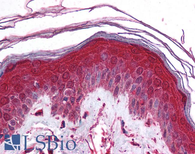 Anti-KCNN3 antibody IHC of human skin. Immunohistochemistry of formalin-fixed, paraffin-embedded tissue after heat-induced antigen retrieval. Antibody LS-B980 concentration 5 ug/ml.