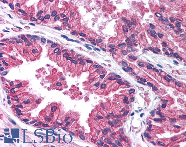 Anti-KCNN3 antibody IHC of human prostate. Immunohistochemistry of formalin-fixed, paraffin-embedded tissue after heat-induced antigen retrieval. Antibody LS-B980 concentration 5 ug/ml.