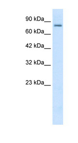 KCNN3 antibody LS-B980 Western blot of Daudi lysate.