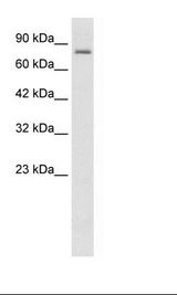 Daudi Cell Lysate