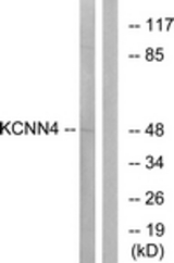 Western blot of extracts from HepG2 cells, using KCNN4 Antibody. The lane on the right was incubated with synthetic peptide.