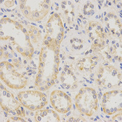 Immunohistochemistry of paraffin-embedded human kidney using KCNN4 antibody at dilution of 1:200 (x400 lens).
