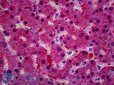Anti-KCNN4 antibody IHC of human liver. Immunohistochemistry of formalin-fixed, paraffin-embedded tissue after heat-induced antigen retrieval. Antibody LS-B5138 concentration 3.75 ug/ml.