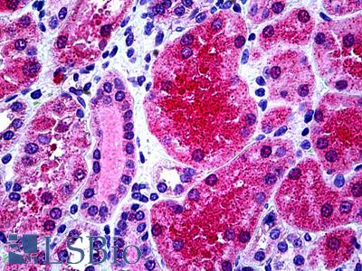 Anti-KCNN4 antibody IHC of human kidney. Immunohistochemistry of formalin-fixed, paraffin-embedded tissue after heat-induced antigen retrieval. Antibody LS-B5138 concentration 3.75 ug/ml.