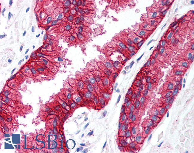 Anti-KCNN4 antibody LS-A9581 IHC of human prostate. Immunohistochemistry of formalin-fixed, paraffin-embedded tissue after heat-induced antigen retrieval.