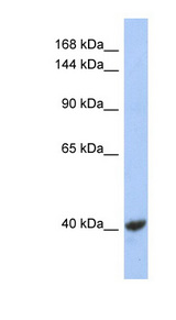 KCNQ2 antibody LS-B6609 Western blot of NCI-H226 cell lysate.