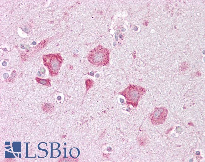 Anti-KCNQ2 antibody IHC of human brain, cortex. Immunohistochemistry of formalin-fixed, paraffin-embedded tissue after heat-induced antigen retrieval. Antibody LS-B6793 concentration 5 ug/ml.