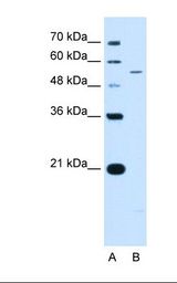Lane A: Marker. Lane B: Jurkat cell lysate. Antibody concentration: 0.5 ug/ml. Gel concentration: 12%.