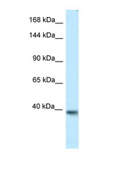 KCNQ2 antibody LS-C145585 Western blot of Mouse Brain lysate. Antibody concentration 1 ug/ml.