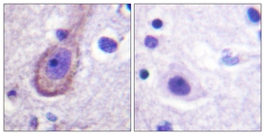 IHC of paraffin-embedded human brain, using Kv7.3/KCNQ3 (Phospho-Thr246) Antibody. The sample on the right was incubated with synthetic peptide.