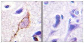 IHC of paraffin-embedded human brain tissue, using Kv7.3/KCNQ3 Antibody. The sample on the right was incubated with synthetic peptide.