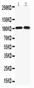 WB of KCNQ5 antibody. All lanes: Anti-KCNQ5 at 0.5ug/ml. Lane 1: Rat Brain Tissue Lysate at 40ug. Lane 2: Mouse Brain Tissue Lysate at 40ug. Predicted bind size: 102KD. Observed bind size: 102KD.