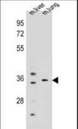 KCNRG Antibody western blot of mouse liver,lung tissue lysates (35 ug/lane). The KCNRG antibody detected the KCNRG protein (arrow).