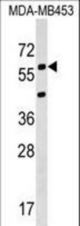 KCNS3 Antibody western blot of MDA-MB453 cell line lysates (35 ug/lane). The KCNS3 antibody detected the KCNS3 protein (arrow).