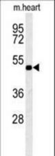 KCNV1 Antibody western blot of mouse heart tissue lysates (15 ug/lane). The KCNV1 antibody detected KCNV1 protein (arrow).