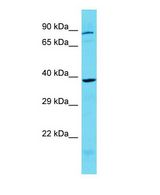 Western blot of KCTD1 Antibody - C-terminal region with human MCF7 cells lysate.