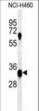 Western blot of KCTD1 Antibody in NCI-H460 cell line lysates (35 ug/lane). KCTD1 (arrow) was detected using the purified antibody.